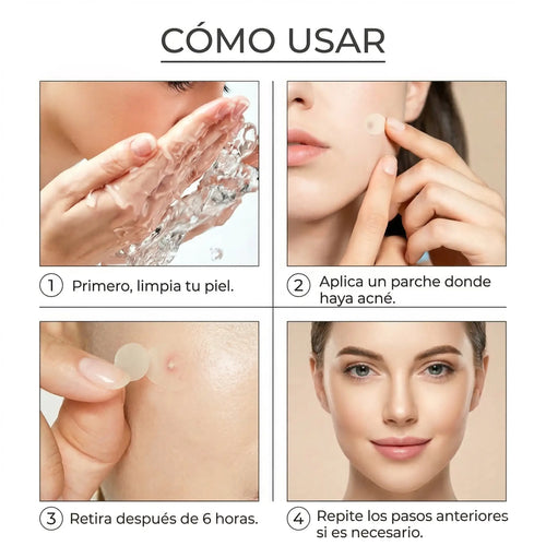 Parche Anti-Acné ClearSkin