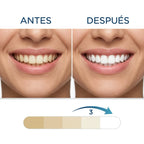 Tiras Blanqueadoras Dentales Rápidas