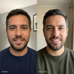 Tiras Blanqueadoras Dentales Rápidas